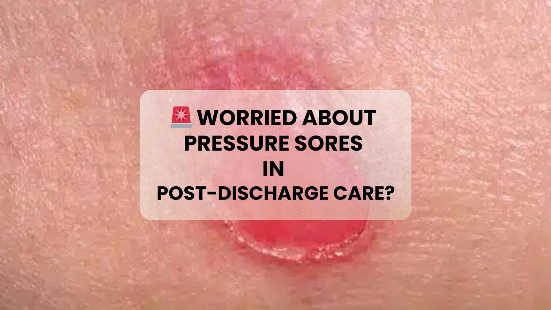 Worried About Pressure Sores After Hospital Discharge? Here’s What You Need to Know!