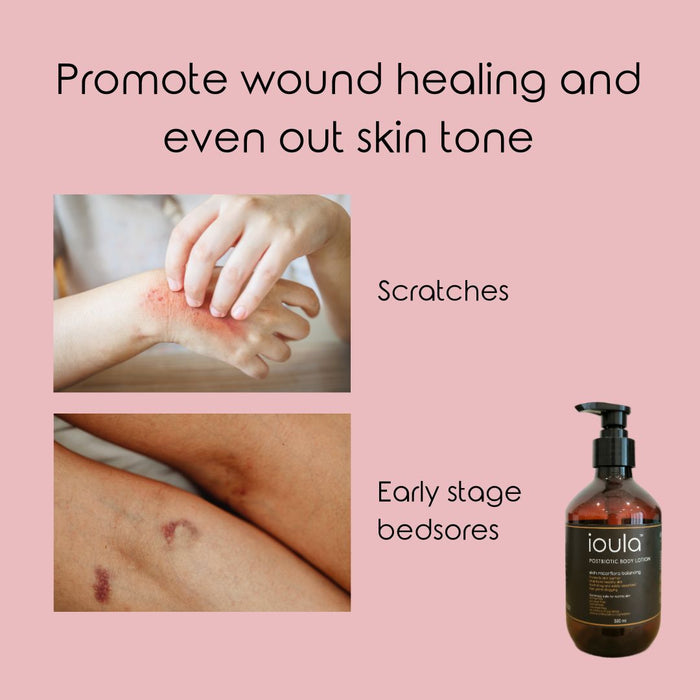 Postbiotic Body Lotion 330 ml | ioula