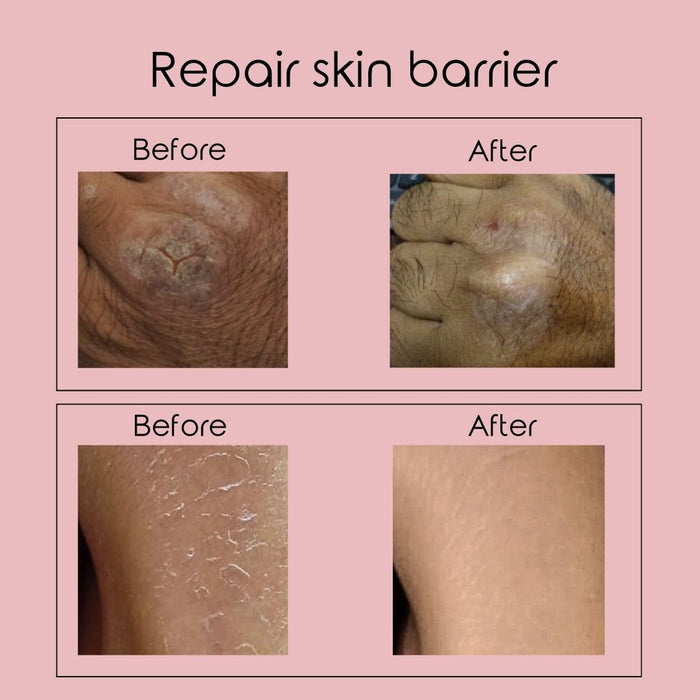 Postbiotic Body Lotion 330 ml | ioula